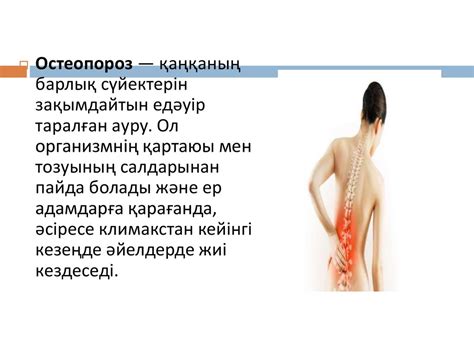 Остеопороз - презентация онлайн