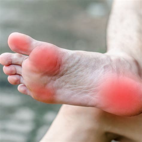 prevent common foot problems  jersey podiatric physicians