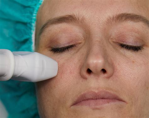 academy anatomy midface cutaneous