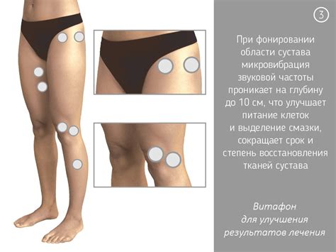 Книгу Федорова Витафон - allegeeuropean