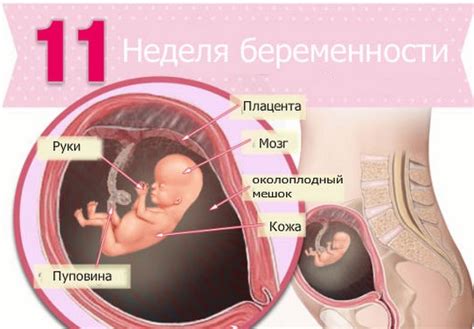 Одиннадцатая неделя беременности: признаки, симптомы, выделения, ощущения