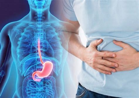 Какво трябва да знаем за рефлукс — Medconsult.bg