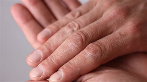 You might have cocaine in your fingerprints | Fox News