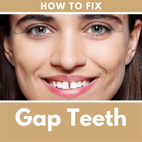 fix gap teeth