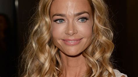 Denise Richards Botox