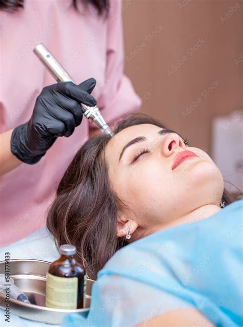 Treatment of the scalp for hair loss, alopecia. A trichologist doctor ...