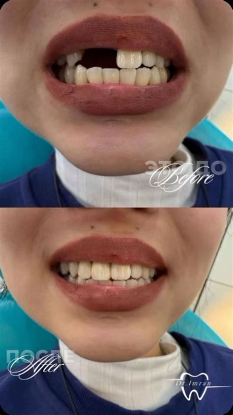 𝗞𝗛𝗔𝗟𝗜𝗗 𝗔𝗦𝗔𝗡𝗢𝗩𝗜𝗖𝗛 𝗗𝗘𝗡𝗧𝗔𝗟 𝗖𝗟𝗜𝗡𝗜𝗖 (@dr.khalid.asanovich) • Instagram ...