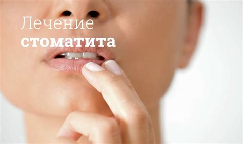 Чем лечить стоматит у ребенка и взрослых и как он передается