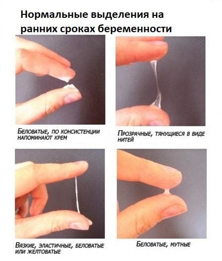 Выделения при беременности до задержки в первые дни после ...