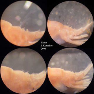 Characteristic groups of spines on urosome somites. | Download ...