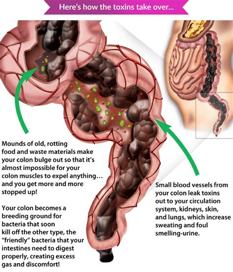 Raisins And Bowel Movements at Colin Jetton blog