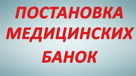 Как ставить банки - YouTube
