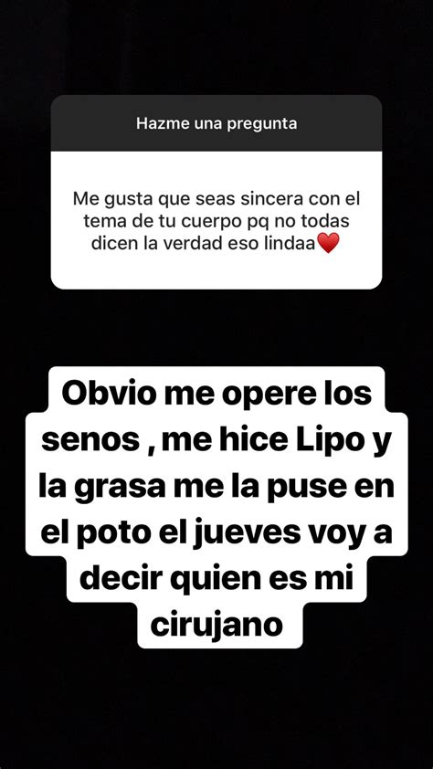 Ignacia Michelson revela todas las cirugías que se ha realizado en su