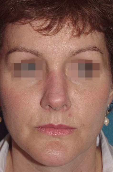 laser  robert  guida md pc