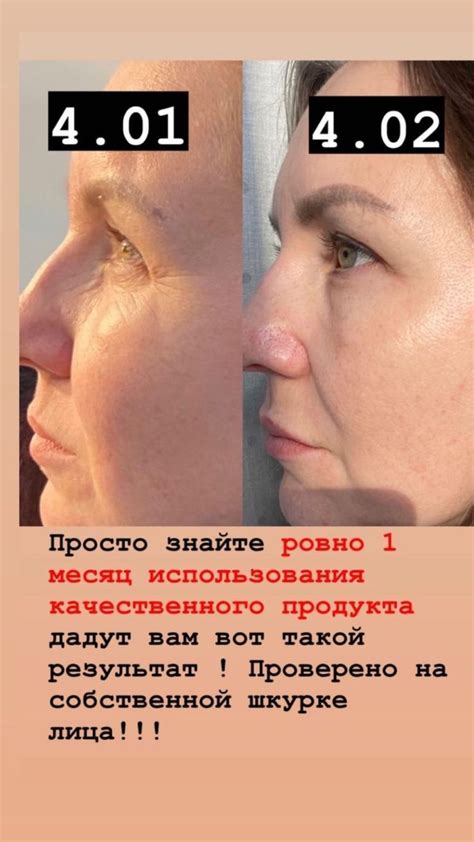 Коллаген Nl | Коллаген, Подтянутая кожа, Гербалайф