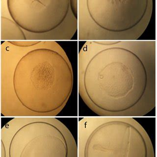 Morphology of Dissostichus eleginoides (Patagonian toothfish) embryos ...
