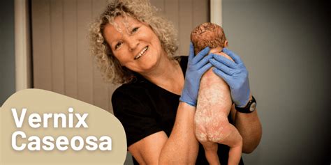 Vernix Caseosa Facts and Benefits | Casa Natal Blog