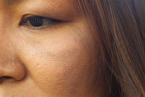 Shrink Large Pores Fast - 5 Minute Vacuuming Method | Women's Alphabet