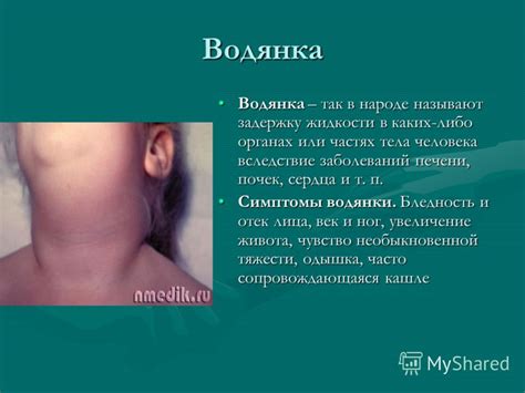 Презентация на тему: "Уильям Визеринг публикует «Рассказ о наперстянке ...
