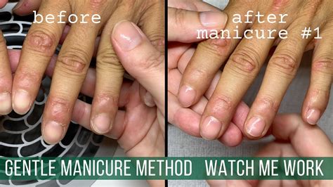 how to fix dry fingernails