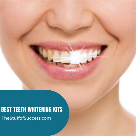 teeth whitening kits  stuff  success