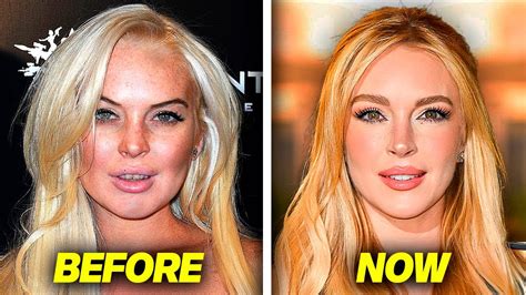 Lindsay Lohan INSANE Transformation Has People SHOOK.. (a new person