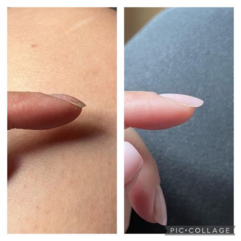 Nail Correction : r/Nails