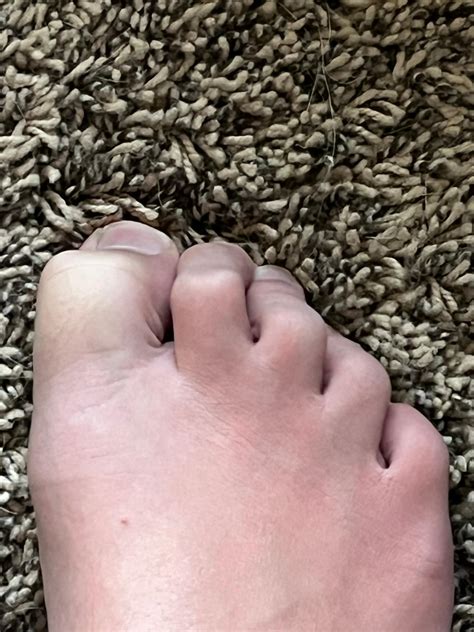 scrunched between your toes by orvilleman1 on DeviantArt