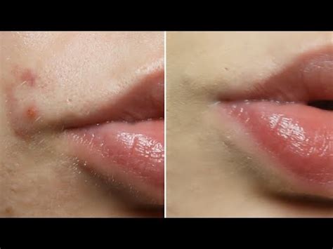 How To Cover Spots With Makeup In 5 Easy Steps! - YouTube