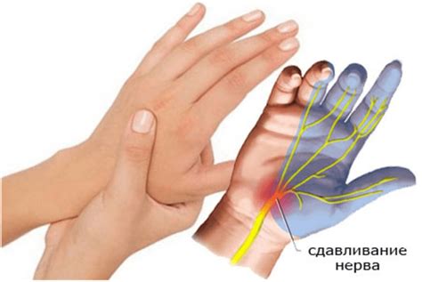 Почему немеют подушечки пальцев на руках