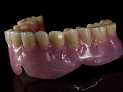 еластична протеза Archives | Dunev Dental Lab