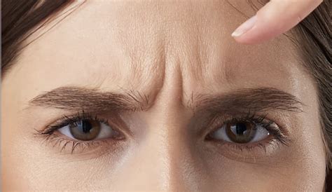 frown lines adelaide advanced cosmetic medicine