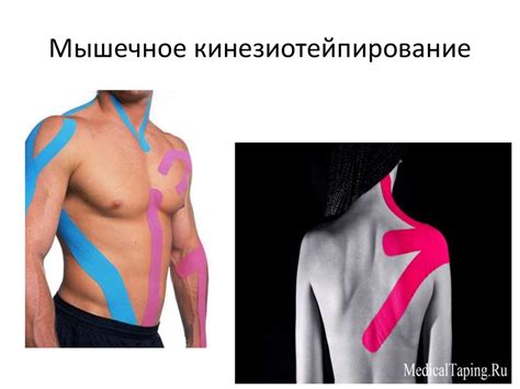 Кинезиотейпирование - презентация онлайн