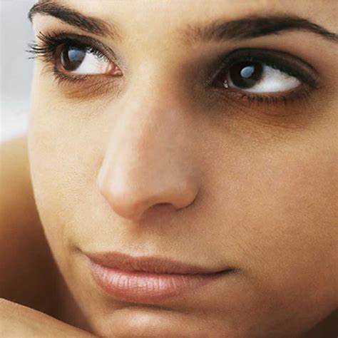 dark circles   eyes   treatments gharparco