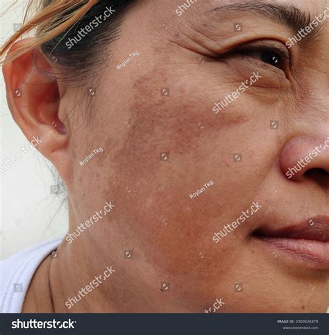 dull face skin royalty  images stock  pictures shutterstock