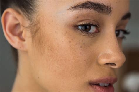 hilangkan parut luka  muka shinbujueung web