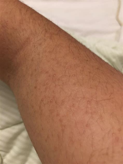 Is this the work of any sort of bed bug or anything? I do remember that ...