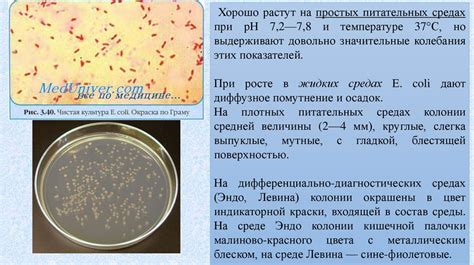 Кишечная палочка - презентация онлайн