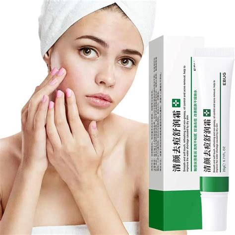 Acne Removal Cream