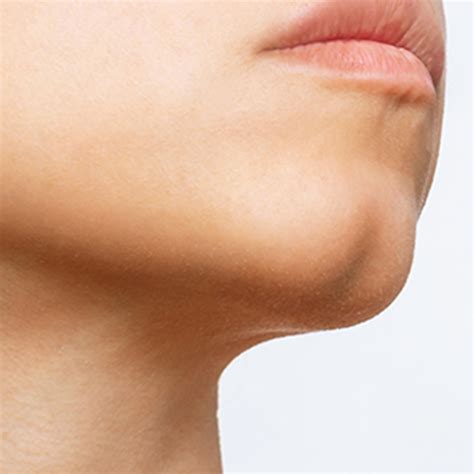 What causes cleft chin? - The Tech Interactive