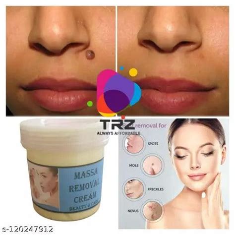 Massa,Wart Removing 100% Herbal Ayurvedic cream – Springkart