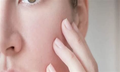 kembalikan tekstur kulit wajah  tak rata akurat