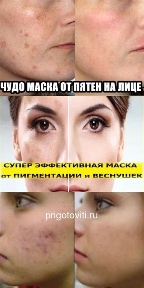 РЕЦЕПТ ОЧЕНЬ ЭФФЕКТИВНОЙ МАСКИ ОТ ЛЮБЫХ ПЯТЕН НА ЛИЦЕ - Все своими руками