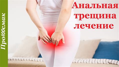 Лечение трещины заднего прохода без операции. Анальная трещина - YouTube