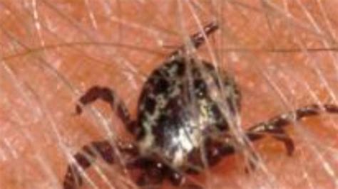TICK SEASON: Missouri Department of Conservation wants your ticks