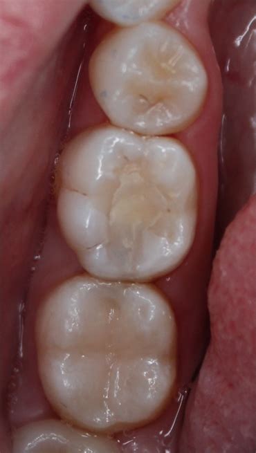 Дентална практика DentaCool д-р Калина Георгиева | Зъболекари | Dental.bg
