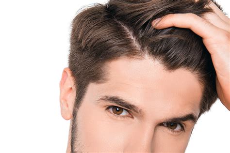 Abnormal hair loss – mdpros.co