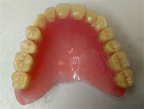 rebazacia-nova-elastichna-proteza-vertex-thermosens-snimka-8 | Dunev ...