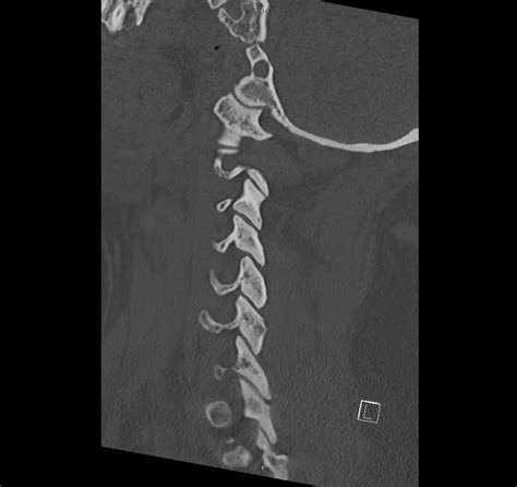 50 - Differential Diagnosis of