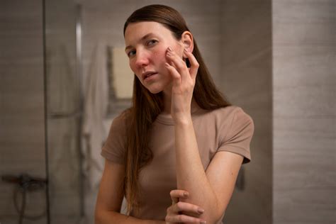 Dry Skin- Symptoms, Causes, & Treatment